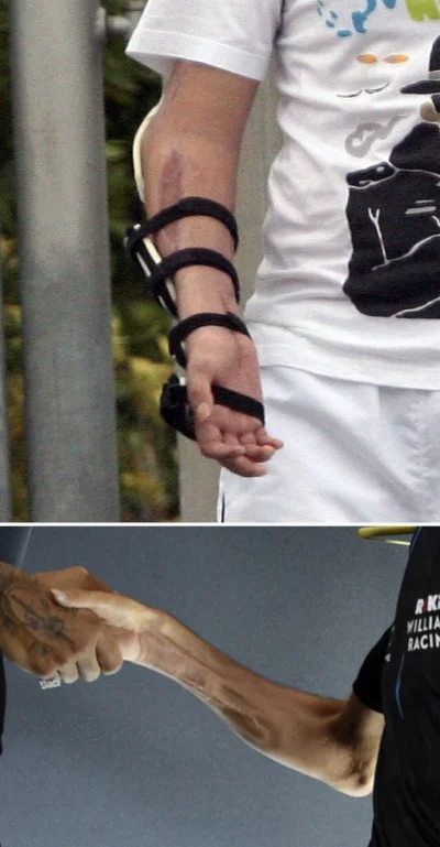 adam-buksa96 - @lubiewachacstopy_siostrze997: bezpośrednio po wypadku ta renka jakoś ...