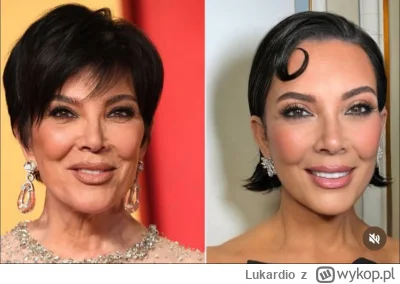 Lukardio - #seriale #showbiznes #operacjeplastyczne #lifting #gownowpis #kardashian