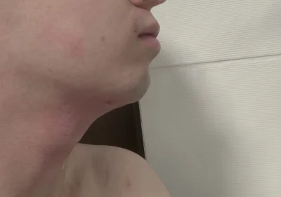 s.....5 - #przegryw ogolon. Lepiej przed czy po? W komentarzu zdjęcie przed