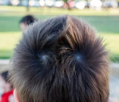 RobieZdrowaZupke - Chłop ma podwójny wir włosów na głowie. Łojciec zawsze się śmiał, ...