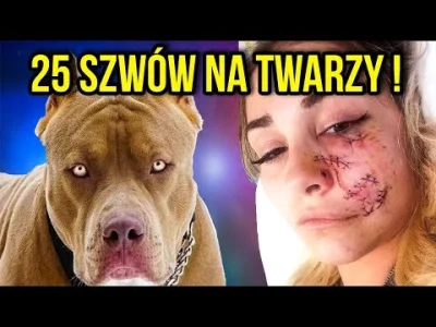 powsinogaszszlaja - DLACZEGO PIES ZAATAKOWAŁ WŁAŚCICIELA ?!

Jak dbać o psa.

#psy #b...