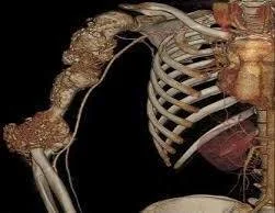 prof-tomasz-trapez - Ciekawe czy czteroletnie dziecko które dostało raka kości wierzy...