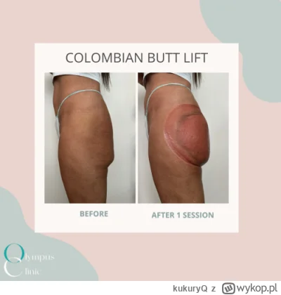 kukuryQ - Przeszukałem google co to za cudo... 
Niby nie modelka, ale widać efekt, ch...