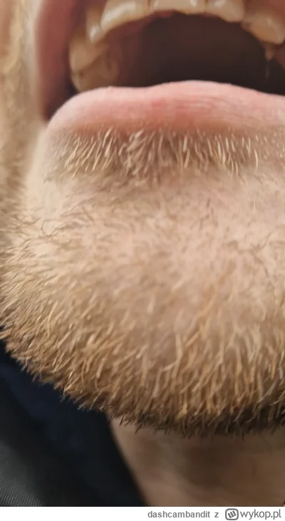 dashcambandit - Dzień Dobry, w związku z opublikowanym w mediach społecznościowych na...