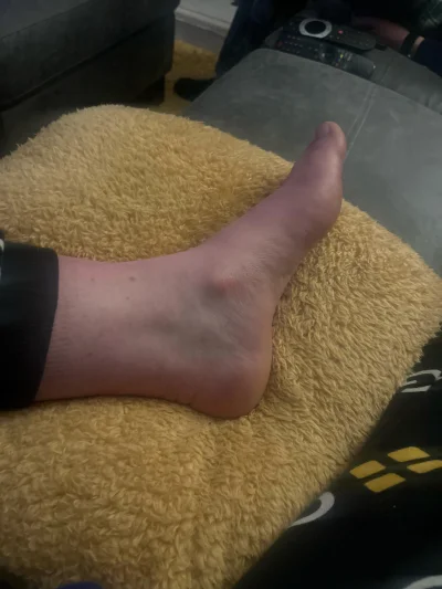 cheeseandonion - My husband says my ankle is in the wrong place , Iv never thought ab...