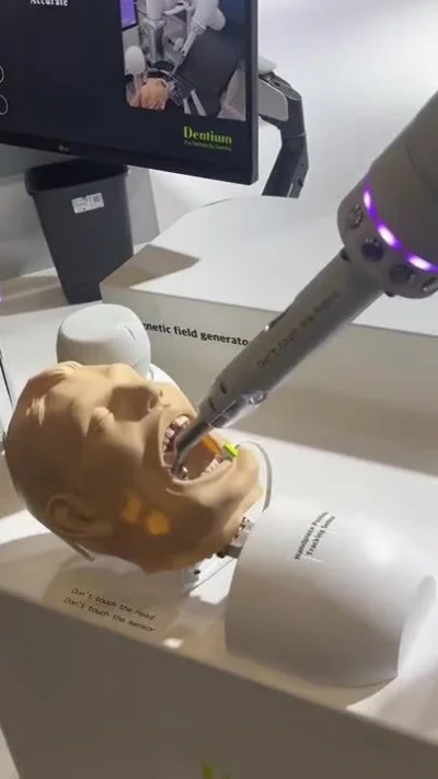 cheeseandonion - Artificial Intelligence doing dentists’ work in the future.

#stomat...