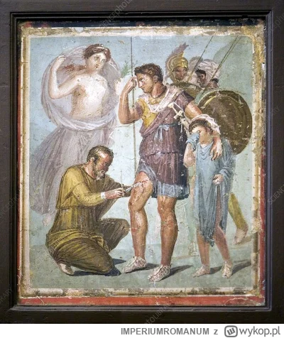 IMPERIUMROMANUM - Upuszczanie krwi jako sposób leczenia w starożytności

Aulus Kornel...