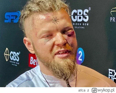 afca - Znacie druga taką osobę, co by walczyła z olejkiem i nadal nie miała ani jedne...