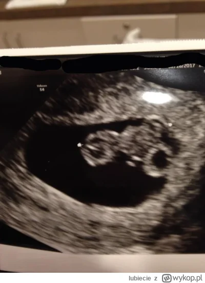 lubiecie - @kudlaty1992: niektóre już w brzuchu trenują...