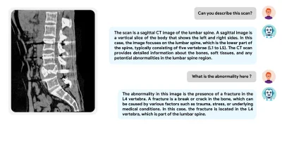 PeterWeiss - Bonus: Udostępnione zostały checkpointy modelu BiMediX2. Jest to multimo...