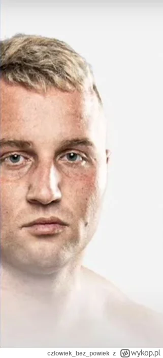 czlowiekbezpowiek - #famemma WYŚLIJ SMS O TREŚCI CHUJWDUPE NA NR 997