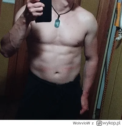 WolvvloW - #mikrokoksy #zdrowie #kiciochpyta pytanie, trochę mam kompleksy

Od około ...