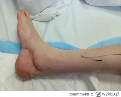 tommmekk - @tommmekk