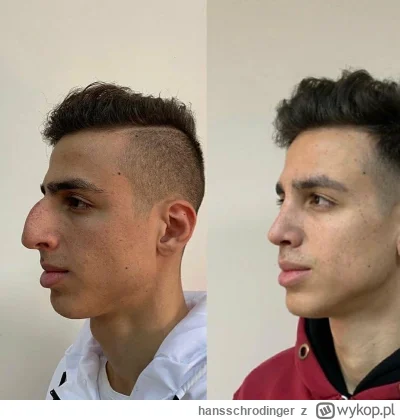 hansschrodinger - @Kreek: @abc-def @itsoverforme32445 Najlepsza terapia dla każdego (...