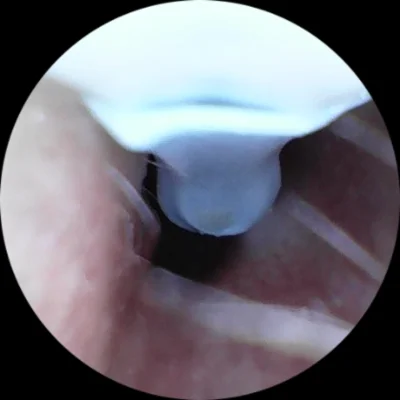 ZdzislawRotterdam - Bezprzewodowy endoskop do czyszczenia ucha to jest top wynalazek ...