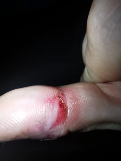 SatanWasa_Babyboomer - szczypie :/