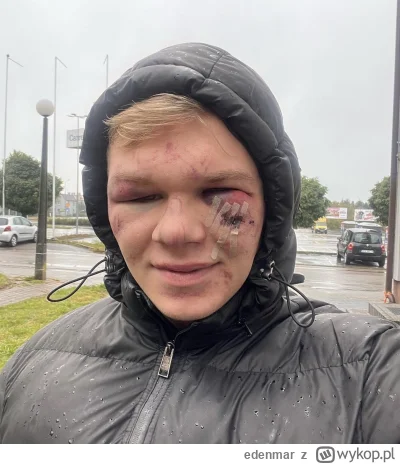 edenmar - @guavatape: przeżył