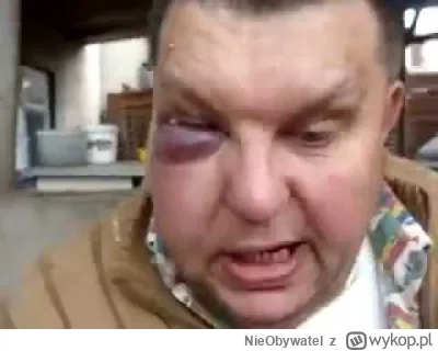 NieObywatel - A ty Kapelko trafisz do pierdelka albo do gazu gdzie twoje miejsce
#pri...