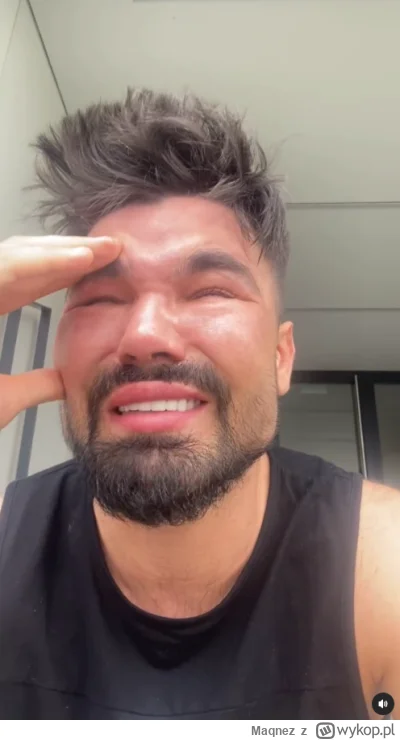 Maqnez - @panDario: to była tragedia kiedy jego morda nie wyglądała idealnie tak jak ...