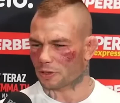 sobor-watykanski - A ten cały u-----y w jagodach znowu 
#famemma