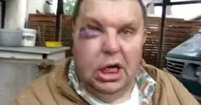 BiednyZaToGlupi - @McBreed: