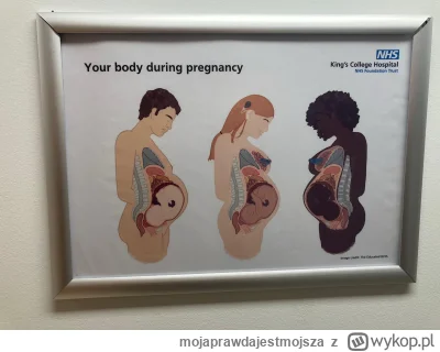 mojaprawdajestmojsza - "Twoje ciało podczas ciąży" 

Baner w SZPITALU w #uk

#clownwo...