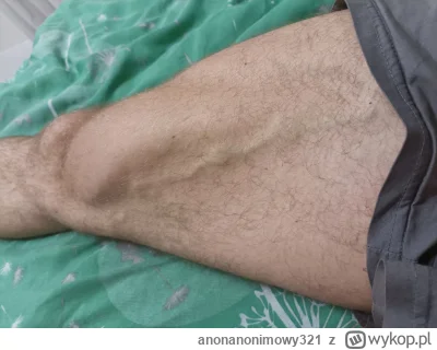 anonanonimowy321 - Martwi mnie ta żyła. Waszym zdaniem wygląda normalnie czy to mogą ...