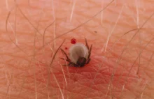 Pierwsza taka śmierć na świecie. Kleszcz wywołał groźną reakcję