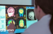 Okres dojrzewania trwa do trzydziestki.