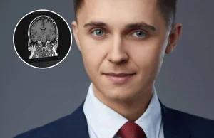 Odkrył przyczynę udaru mózg a wieku 29 lat został prof. - Mateusz Hołda