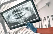 Afera z Dr Smile - nakładki ortodontyczne.
