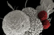 Nowe odkrycia w walce z przerzutami nowotworów. Oliwa jednak nie zdrowa