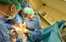 Jeden dawca, dwóch biorców: pierwsze takie przeszczepienie wątroby w Polsce
