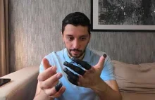 Pan opowiada o swoich odmrożeniach