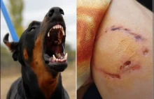 Aż 100 ataków dziennie. Rośnie liczba pogryzień przez psy.