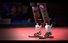 Nowe bioniczne nogi - fascynuyjący wynalazek