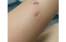 Obowiązkowe ubezpieczenie psów - konieczność czy fanaberia?