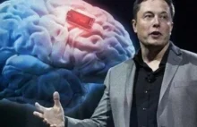 Musk dostał zgodę na wszczepianie chipów do mózgu. Ludzie boją się, że wybuchną