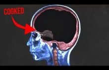 Historia zatrucia bromem po konsultacji z ChatGPT [ENG]