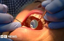 Próchnica może odejść w zapomnienie?