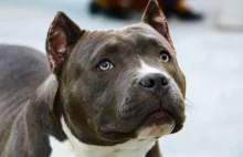 Seria krwawych ataków psów. Bosak: życie człowieka ważniejsze niż psa