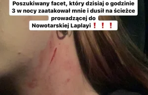 Dramatyczny apel młodej dziewczyny. "Poszukiwany facet, który mnie dusił"