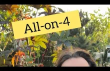 All-on-4 czyli zęby w 1 dzień?