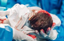 KANADA: W Montrealu zabito dziecko tuż przed porodem