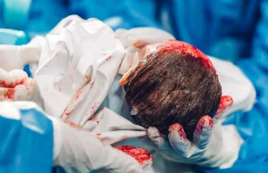 KANADA: W Montrealu zabito dziecko tuż przed porodem