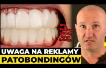Dentysta ujawnia prawdę o 'tureckich zębach'