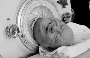 Polio Paul nie żyje. Przez ponad 70 lat żył w żelaznym płucu.