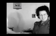 Kobieta przed i po lobotomii nagranie wideo z 1944