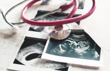 8 marca Sejm zajmie się projektem zaostrzającym prawo do aborcji.