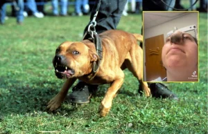 USA: Została zaatakowana przez psa. Straciła nos.